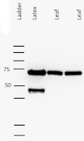 Linamarase in the group Antibodies Plant/Algal / Carbohydrates at Agrisera AB (Antibodies for research) (AS15 2862)